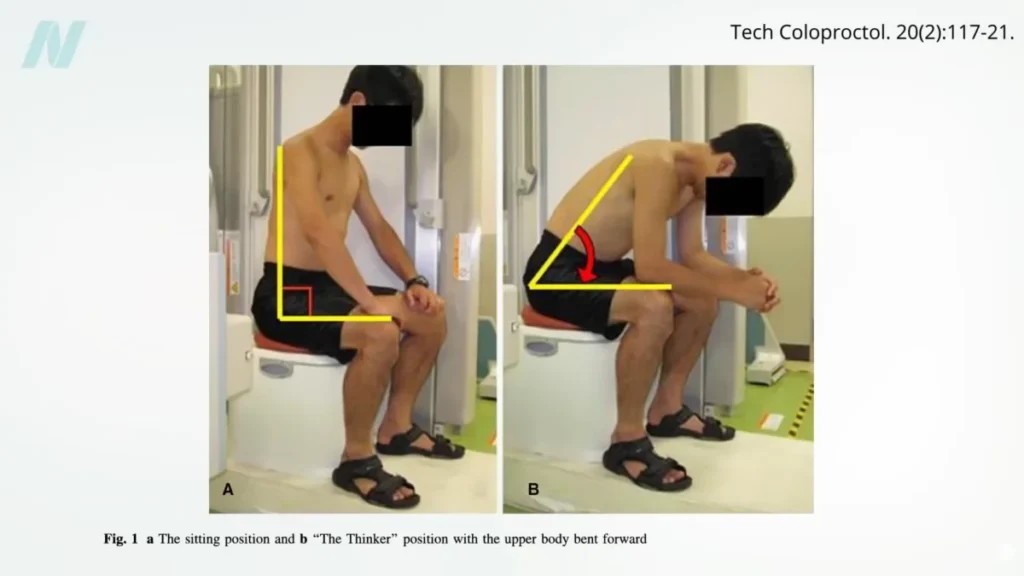 unveiling-the-optimal-posture-the-squatty-potty-put-to-the-test-and-the-broader-bowel-movement-debate