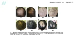 beyond-the-follicle-unpacking-the-dietary-connection-to-hair-loss-and-regrowth
